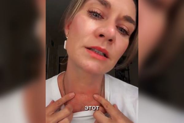 Мария Машкова впервые рассказала о борьбе с раком: «Уникальный московский хирург меня спас»