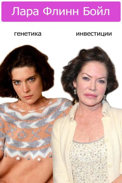 Генетика VS инвестиции: 10 звезд, которые вложили миллионы в свою внешность (11 фото)
